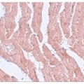 LZTR1 Antibody - Immunohistochemistry of LZTR1 in mouse heart tissue with LZTR1 antibody at 5 µg/mL.