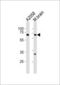 LZTS1 Antibody - LZTS1 Antibody western blot of A2058 cell line and mouse brain tissue lysates (35 ug/lane). The LZTS1 antibody detected the LZTS1 protein (arrow).