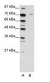 LZTS1 Antibody - A: Marker, B: Jurkat Cell Lysate.  This image was taken for the unconjugated form of this product. Other forms have not been tested.