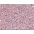 LZTS3 Antibody - Immunohistochemistry of Prosapip1 in rat brain tissue with Prosapip1 antibody at 2.5 µg/mL.