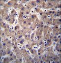 M-PST / STM Antibody - SULT1A3/SULT1A4 Antibody immunohistochemistry of formalin-fixed and paraffin-embedded human liver tissue followed by peroxidase-conjugated secondary antibody and DAB staining.This data demonstrates the use of SULT1A3/SULT1A4 Antibody for immunohistochemistry.