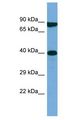 M1AP Antibody - M1AP antibody Western Blot of Jurkat. Antibody dilution: 1 ug/ml.  This image was taken for the unconjugated form of this product. Other forms have not been tested.