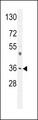 M6PR Antibody - M6PR Antibody western blot of A549 cell line lysates (35 ug/lane). The M6PR antibody detected the M6PR protein (arrow).