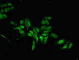 MAB21L2 Antibody - Immunofluorescent analysis of Hela cells at a dilution of 1:100 and Alexa Fluor 488-congugated AffiniPure Goat Anti-Rabbit IgG(H+L)