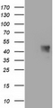 MAB21L3 / C1orf161 Antibody - HEK293T cells were transfected with the pCMV6-ENTRY control (Left lane) or pCMV6-ENTRY C1orf161 (Right lane) cDNA for 48 hrs and lysed. Equivalent amounts of cell lysates (5 ug per lane) were separated by SDS-PAGE and immunoblotted with anti-C1orf161.