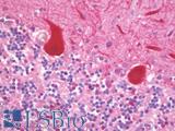 MAGEA3 Antibody - Human Brain, Cerebellum: Formalin-Fixed, Paraffin-Embedded (FFPE) 