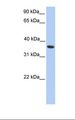 MAGEA4 Antibody - HepG2 cell lysate. Antibody concentration: 1.0 ug/ml. Gel concentration: 12%.  This image was taken for the unconjugated form of this product. Other forms have not been tested.