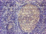 MAGEB18 Antibody - IHC of paraffin-embedded Human tonsil using anti-MAGEB18 mouse monoclonal antibody.