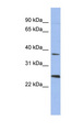 MAGEB2 Antibody - MAGEB2 antibody Western blot of Placenta lysate. This image was taken for the unconjugated form of this product. Other forms have not been tested.