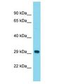 MAGEB5 Antibody - MAGEB5 antibody Western Blot of Fetal Liver. Antibody dilution: 1 ug/ml.  This image was taken for the unconjugated form of this product. Other forms have not been tested.