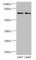 MAGEC3 Antibody - Western blot All lanes: MAGEC3 antibody at 2µg/ml Lane 1: A375 cells Lane 2: Rat thymus tissue Secondary Goat polyclonal to rabbit IgG at 1/10000 dilution Predicted band size: 72, 39 kDa Observed band size: 72 kDa