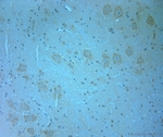 MAGI2 / AIP-1 Antibody - Rabbit antibody to AIP1 (1050-1100). IHC-P on paraffin sections of rat spinal cord tissue. The animal was perfused using Autoperfuser at a pressure of 110 mm Hg with 300 ml 4% FA and further post fixed overnight before being processed for paraffin embedding. HIER: Tris-EDTA, pH 9 for 20 min using Thermo PT Module. Blocking: 0.2% LFDM in TBST filtered through a 0.2 micron filter. Detection was done using Novolink HRP polymer from Leica following manufacturers instructions. Primary antibody: dilution 1:1000, incubated 30 min at RT (using Autostainer). Sections were counterstained with Harris Hematoxylin.
