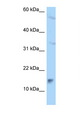 MAGOHB / Mago Antibody - MAGOHB antibody Western blot of A549 Cell lysate. Antibody concentration 1 ug/ml.  This image was taken for the unconjugated form of this product. Other forms have not been tested.