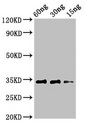 Major pollen allergen Aln g 1 Antibody - Western Blot Positive WB detected in Recombinant protein All lanes: Aln antibody at 3µg/ml Secondary Goat polyclonal to rabbit IgG at 1/50000 dilution predicted band size: 34 kDa observed band size: 34 kDa