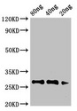 Major Pollen Allergen Art v 1 Antibody - Western Blot Positive WB detected in Recombinant protein All lanes: Art antibody at 3.4µg/ml Secondary Goat polyclonal to rabbit IgG at 1/50000 dilution predicted band size: 27 kDa observed band size: 27 kDa