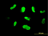 MAK Antibody - Immunofluorescence of monoclonal antibody to MAK on HepG2 cell. [antibody concentration 10 ug/ml]