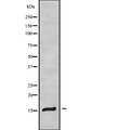 MAL Antibody - Western blot analysis of MAL using COLO205 whole cells lysates