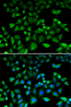 MALIN / NHLRC1 Antibody - Immunofluorescence analysis of HeLa cells.