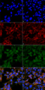 Malondialdehyde Antibody - Immunocytochemistry/Immunofluorescence analysis using Mouse Anti-Malondialdehyde Monoclonal Antibody, Clone 6H6. Tissue: Embryonic kidney epithelial cell line (HEK293). Species: Human. Fixation: 5% Formaldehyde for 5 min. Primary Antibody: Mouse Anti-Malondialdehyde Monoclonal Antibody  at 1:50 for 30-60 min at RT. Secondary Antibody: Goat Anti-Mouse Alexa Fluor 488 at 1:1500 for 30-60 min at RT. Counterstain: Phalloidin Alexa Fluor 633 F-Actin stain; DAPI (blue) nuclear stain at 1:250, 1:50000 for 30-60 min at RT. Magnification: 20X (2X Zoom). (A,C,E,G) - Untreated. (B,D,F,H) - Cells cultured overnight with 50 µM H2O2. (A,B) DAPI (blue) nuclear stain. (C,D) Phalloidin Alexa Fluor 633 F-Actin stain. (E,F) Malondialdehyde Antibody. (G,H) Composite. Courtesy of: Dr. Robert Burke, University of Victoria.