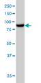 MAN1B1 Antibody - MAN1B1 monoclonal antibody (M01), clone 6B1 Western blot of MAN1B1 expression in A-431.