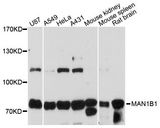 MAN1B1 Antibody - Western blot analysis of extracts of various cell lines, using MAN1B1 antibody at 1:3000 dilution. The secondary antibody used was an HRP Goat Anti-Rabbit IgG (H+L) at 1:10000 dilution. Lysates were loaded 25ug per lane and 3% nonfat dry milk in TBST was used for blocking. An ECL Kit was used for detection and the exposure time was 10s.
