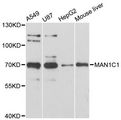 MAN1C1 Antibody - Western blot analysis of extracts of various cell lines, using MAN1C1 antibody at 1:3000 dilution. The secondary antibody used was an HRP Goat Anti-Rabbit IgG (H+L) at 1:10000 dilution. Lysates were loaded 25ug per lane and 3% nonfat dry milk in TBST was used for blocking. An ECL Kit was used for detection and the exposure time was 90s.