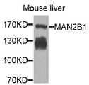 MAN2B1 / LAMAN Antibody - Western blot analysis of extracts of mouse liver cells.