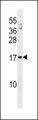 MANF / ARMET Antibody - MANF Antibody western blot of 293 cell line lysates (35 ug/lane). The MANF antibody detected the MANF protein (arrow).