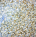 MAOB / Monoamine Oxidase B Antibody - MAOB / Monoamine Oxidase B antibody. IHC(P): Rat Liver Tissue.