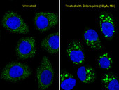 MAP1LC3B / LC3B Antibody - Immunofluorescence of U251 cells, using LC3 Antibody (APG8B). U251 cells(right) were treated with Chloroquine (50 mu M,16h). Antibody was diluted at 1:25 dilution. Alexa Fluor 488-conjugated goat anti-rabbit lgG at 1:400 dilution was used as the secondary antibody (green). DAPI was used to stain the cell nuclear (blue).