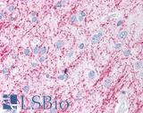 MAP1LC3B / LC3B Antibody - MAP1LC3A antibody (5 ug/ml) was used in IHC to stain formalin-fixed, paraffin-embedded human brain, cortex, followed by biotinylated goat anti-rabbit IgG secondary antibody, alkaline phosphatase-streptavidin and chromogen. This image was taken for the unconjugated form of this product. Other forms have not been tested.
