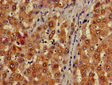 MAP1LC3C / LC3C Antibody - Immunohistochemistry of paraffin-embedded human liver tissue using MAP1LC3C Antibody at dilution of 1:100