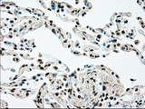 MAP2K4 / MKK4 Antibody - IHC of paraffin-embedded lung tissue using anti-MAP2K4 mouse monoclonal antibody. (Dilution 1:50).