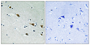MAP2K7 / MEK7 Antibody - Immunohistochemistry analysis of paraffin-embedded human brain, using MAP2K7 (Phospho-Ser271) Antibody. The picture on the right is blocked with the phospho peptide.