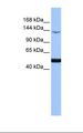 MAP3K1 / MEKK1 Antibody - 721_B cell lysate. Antibody concentration: 1.0 ug/ml. Gel concentration: 6-18%.  This image was taken for the unconjugated form of this product. Other forms have not been tested.