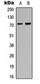 MAP3K1 / MEKK1 Antibody - Western blot analysis of MEKK1 expression in SHSY5Y (A); rat lung (B) whole cell lysates.