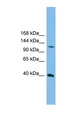 MAP3K14 Antibody - MAP3K14 antibody Western blot of THP-1 cell lysate. This image was taken for the unconjugated form of this product. Other forms have not been tested.