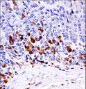MAP3K6 / MEKK6 Antibody - Mouse Map3k6 Antibody immunohistochemistry of formalin-fixed and paraffin-embedded mouse stomach tissue followed by peroxidase-conjugated secondary antibody and DAB staining.