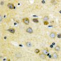 MAP3K7 / TAK1 Antibody - Immunohistochemical analysis of TAK1 (pT187) staining in human brain formalin fixed paraffin embedded tissue section. The section was pre-treated using heat mediated antigen retrieval with sodium citrate buffer (pH 6.0). The section was then incubated with the antibody at room temperature and detected using an HRP conjugated compact polymer system. DAB was used as the chromogen. The section was then counterstained with hematoxylin and mounted with DPX.