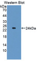 MAP3K7CL / TAK1L Antibody - Western blot of MAP3K7CL / TAK1L antibody.