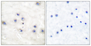MAP3K8 / TPL2 Antibody - Immunohistochemistry analysis of paraffin-embedded human brain tissue, using COT Antibody. The picture on the right is blocked with the synthesized peptide.