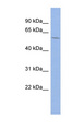 MAP3K8 / TPL2 Antibody - MAP3K8 antibody Western blot of THP-1 cell lysate. This image was taken for the unconjugated form of this product. Other forms have not been tested.