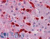 MAP4K4 Antibody - Anti-MAP4K4 antibody IHC of human liver. Immunohistochemistry of formalin-fixed, paraffin-embedded tissue after heat-induced antigen retrieval. Antibody concentration 5 ug/ml.  This image was taken for the unconjugated form of this product. Other forms have not been tested.