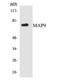 MAP9 Antibody - Western blot analysis of the lysates from HUVECcells using MAP9 antibody.