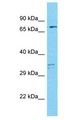 MAP9 Antibody - MAP9 antibody Western Blot of MCF7. Antibody dilution: 1 ug/ml.  This image was taken for the unconjugated form of this product. Other forms have not been tested.