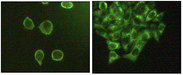MAPK10 / JNK3 Antibody - Immunofluorescence staining of methanol-fixed A431 (left) and HeLa (right) cells showing cytoplasmic and membrane localization.