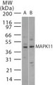 MAPK11 / SAPK2 / p38 Beta Antibody - Western blot of MAPK11 in 15 ugs of (A) human brain and (B) mouse brain cell lysate using antibody at 2 ug/ml.