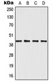 MAPK12 / ERK6 / SAPK3 Antibody - Western blot analysis of SAPK3 expression in Jurkat (A); HeLa (B); NIH3T3 (C); H9C2 (D) whole cell lysates.