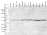 MAPK14 / p38 Antibody - Multi-blot analysis of p38 in a cell lysate from 12 human cancer cell lines using a 1:1000 dilution of MAPK14 / p38 antibody.