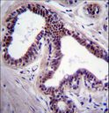 MAPK8 / JNK1 Antibody - MAPK8 Antibody immunohistochemistry of formalin-fixed and paraffin-embedded human breast tissue followed by peroxidase-conjugated secondary antibody and DAB staining.